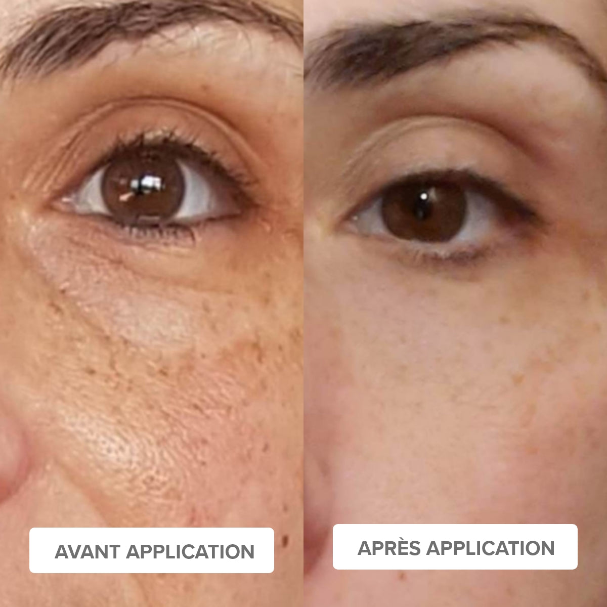 ANTI-DARK ROUTINE - Brightening &amp; Unifying